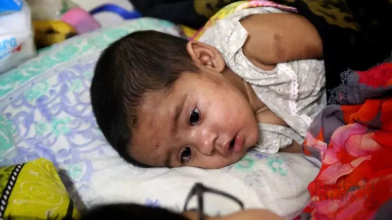 Measles outbreak: Death toll reaches 712 as four children die in 24 hours